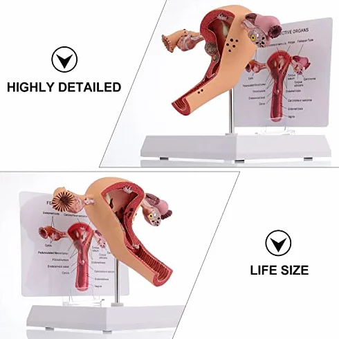 Model anatomii żeńskich narządów rozrodczych narzędzie do badania patologicznego macicy i jajnika edukacja medyczna