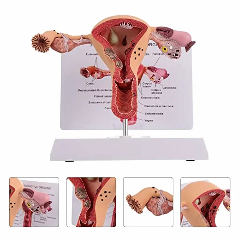Model anatomii żeńskich narządów rozrodczych narzędzie do badania patologicznego macicy i jajnika edukacja medyczna