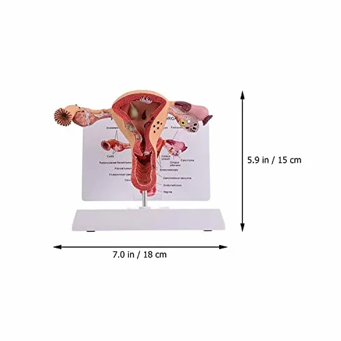Model anatomii żeńskich narządów rozrodczych narzędzie do badania patologicznego macicy i jajnika edukacja medyczna