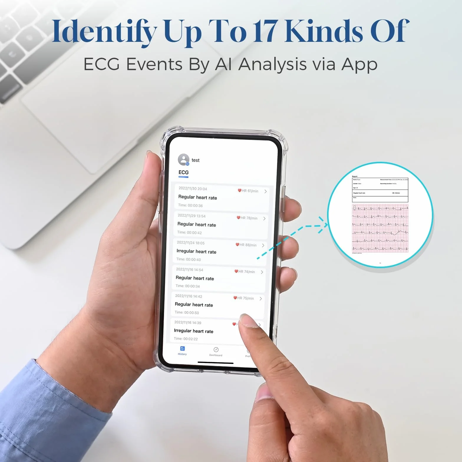 CheckMe DuoEK-S urządzenie EKG z analizą raportów EKG do domu, monitorowanie 30-5 min, bezprzewodowy przenośny monitor EKG Bluetooth z aplikacją do iOS i Android