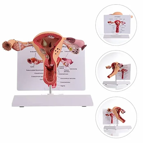 Model anatomii żeńskich narządów rozrodczych narzędzie do badania patologicznego macicy i jajnika edukacja medyczna