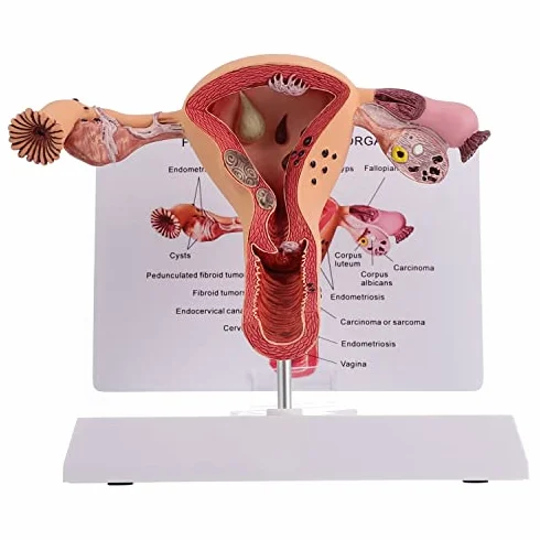 Model anatomii żeńskich narządów rozrodczych narzędzie do badania patologicznego macicy i jajnika edukacja medyczna